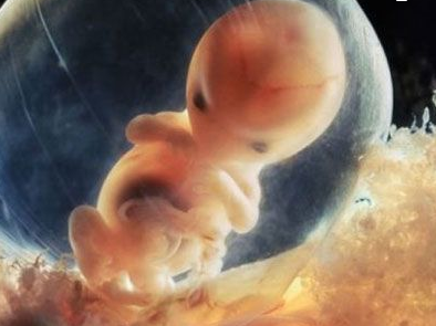 好奇!三个月的胎儿外形是怎么样的?